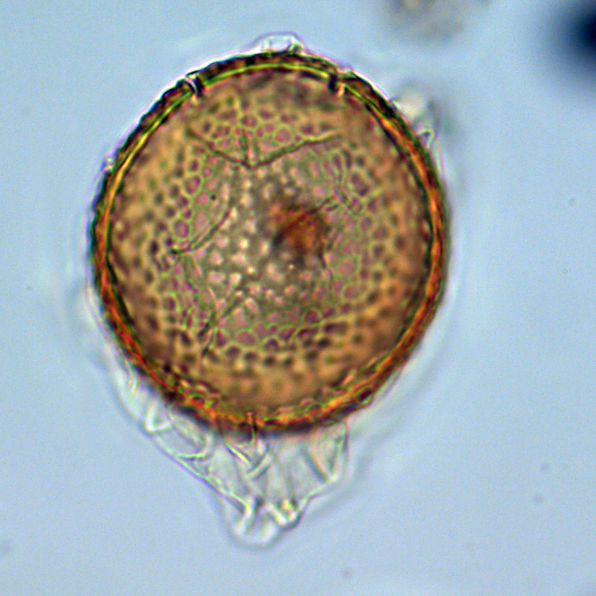 Leberidocysta chlamydata, U1581-26R-4W, 84-88, sl. 1, O28, foto-e.jpg